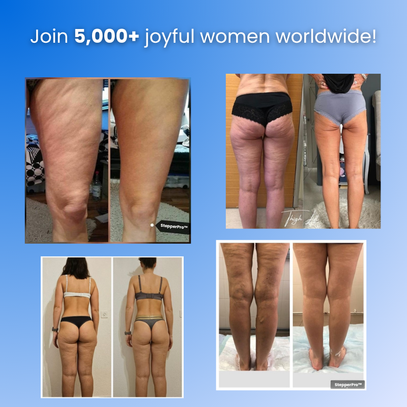 StepperPro™